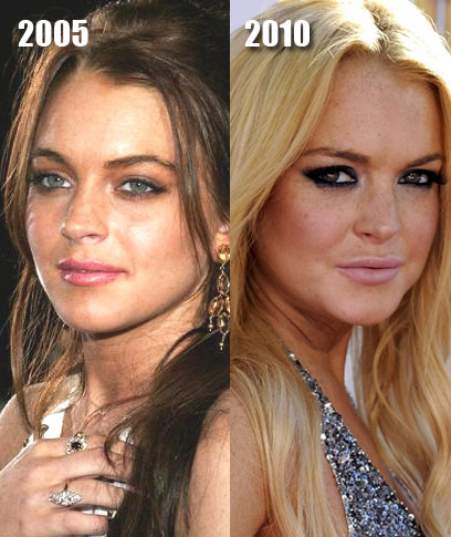 Is plastic surgery making you look older?